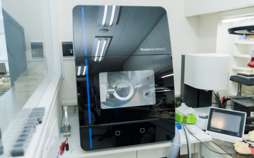 院内技工室完備でスピーディな治療